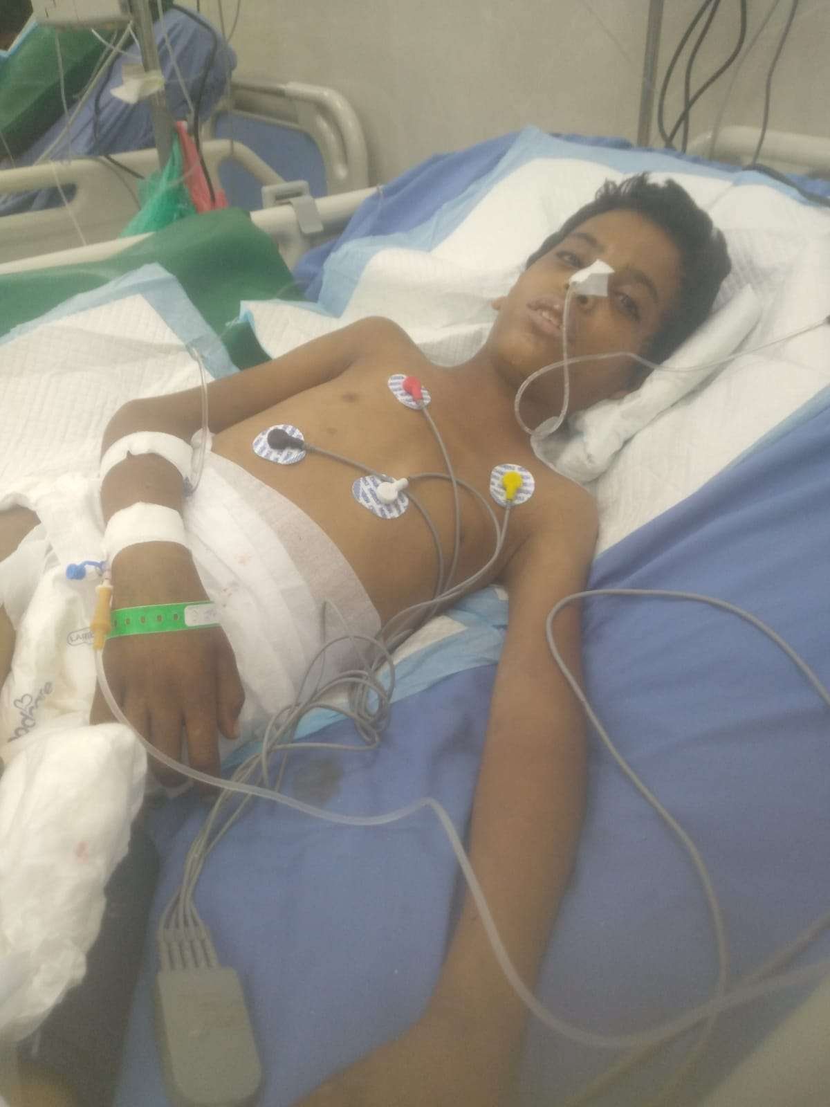 استشهاد طفل متأثرًا بإصابته برصاص قناص حوثي في كرش