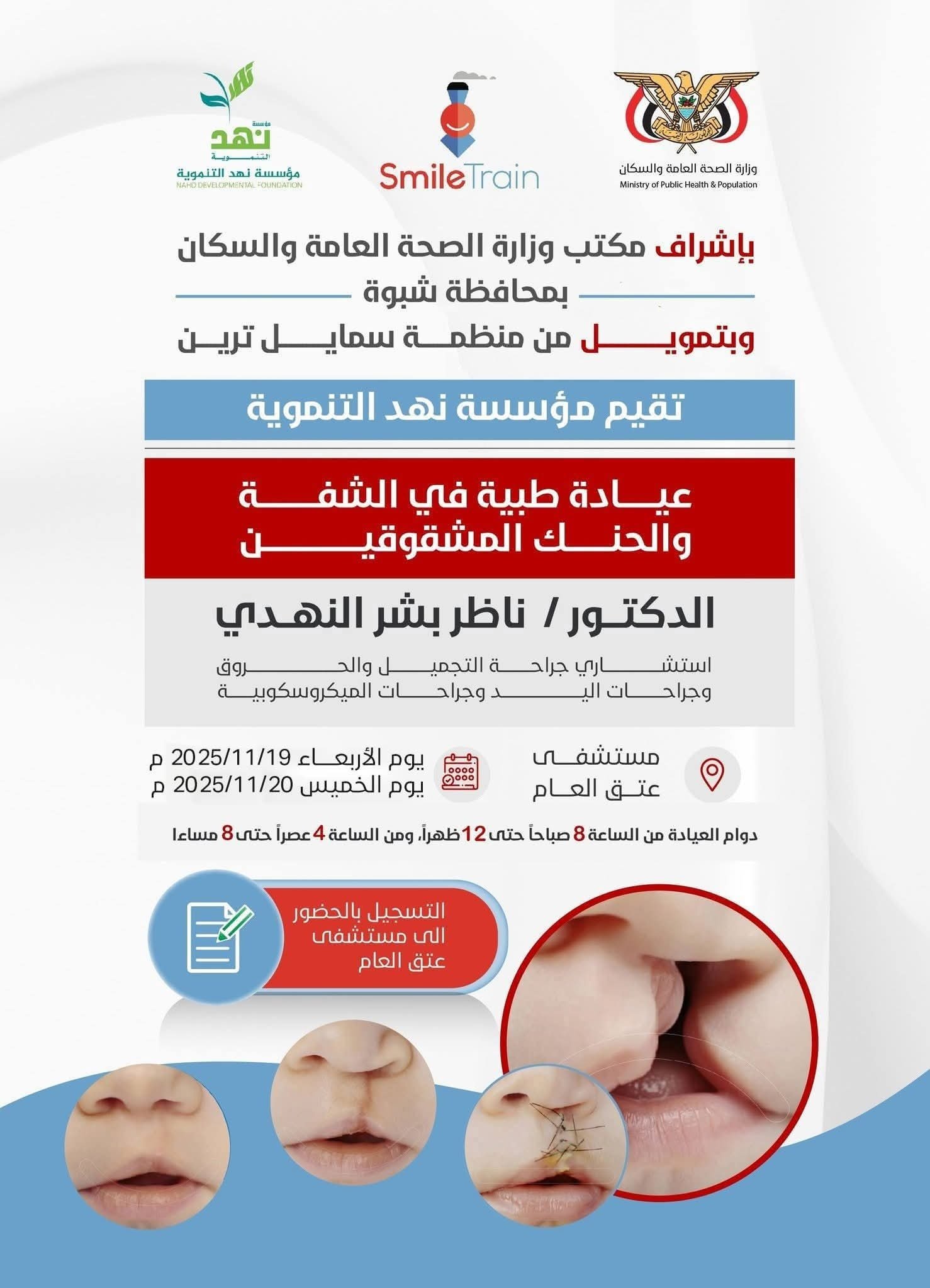 برعاية المحافظ بن الوزير.. عيادة  طبية لحالات الشفة الأرنبية في مستشفى شبوة للأمومة والطفولة