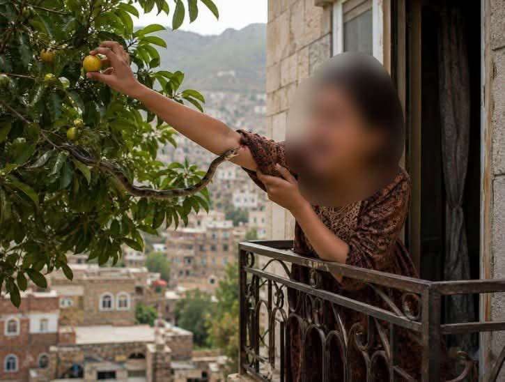 فتاة في تعز تتعرض ل 11 لدغة ثعبان أحدها في غرفة الحجر الصحي وتفتح بابًا مرعبًا من التساؤلات