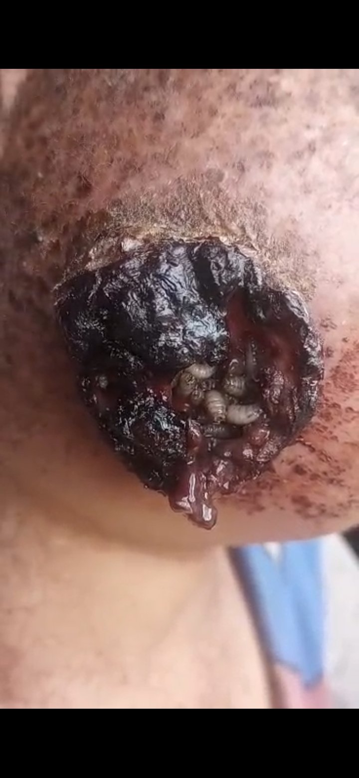 نداء إنساني عاجل.. مأساة أسرة يلتهم السرطان أطفالها ووالدهم عاجز عن توفير مسكّن للألم