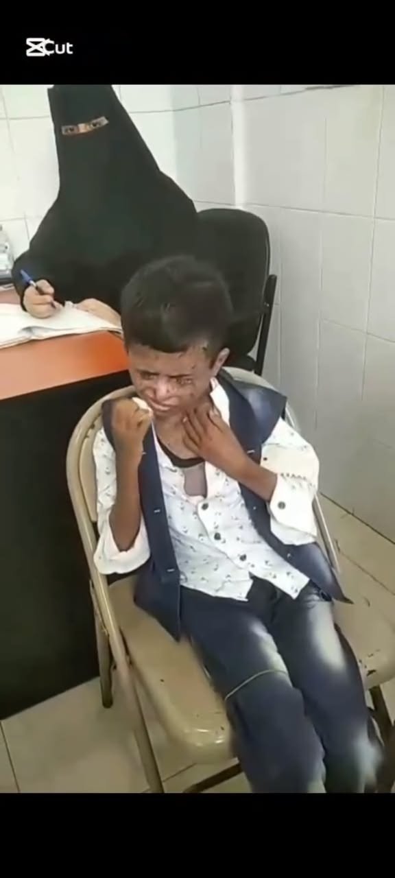 استجابة للمناشدة الإنسانية التي اطلقتها الجريدة بوست.. الشيخ نايف جرهوم يتكفل بالعلاج الشامل للطفلين غازي وعارف